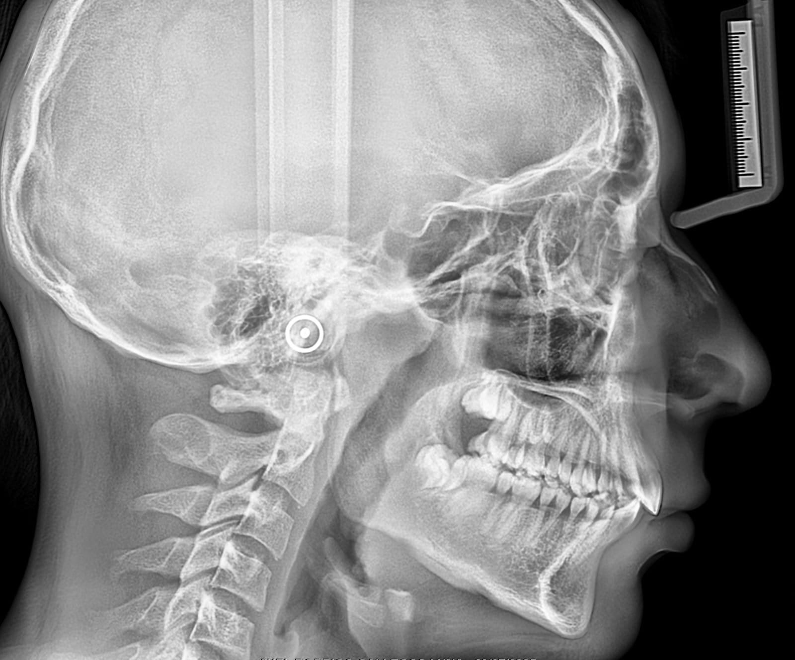 Radiología 2D